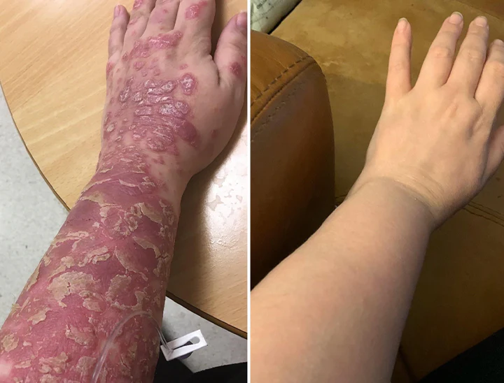 QIAWI™ All-in-One CO₂ Laser Eraser Pen image QIAWI™ All-in-One CO₂ Laser Eraser Pen