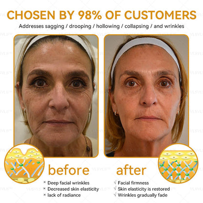 LOVILDS™ Bee Essence Skin Antibacterial Cream—used to treat a variety of skin diseases (AAD recommended)